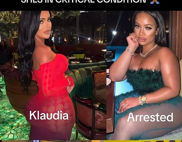 Klaudia Glam, Accident UK Influencer battles for her life after being run over by a woman